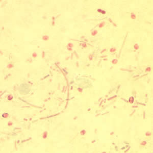 Ebieneusi_spores_chromo2012.jpg