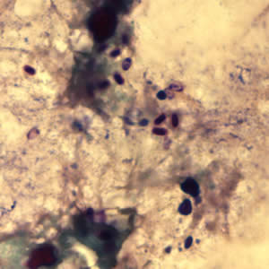 Ecuniculi_spores_gramchromo3_2012.jpg