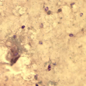 Ecuniculi_spores_gramchromo_2012.jpg
