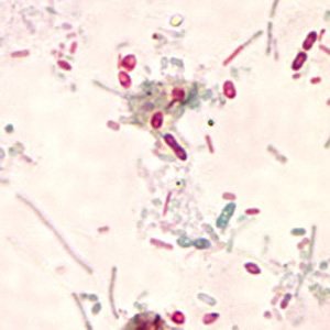 Microsporidia_2012.jpg