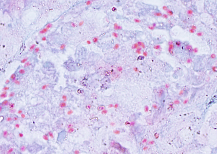 Ec_MAYO_KidneyTrichrome.jpg