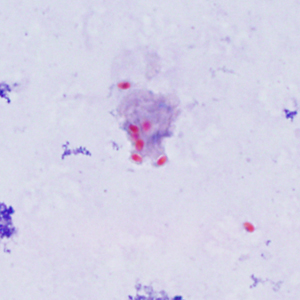 Ec_MAYO_Trichrome1.jpg