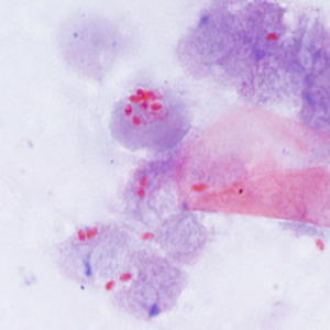 Ec_MAYO_Trichrome2.jpg