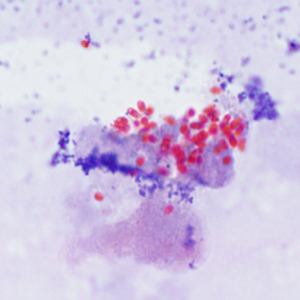 Ec_MAYO_Trichrome3.jpg