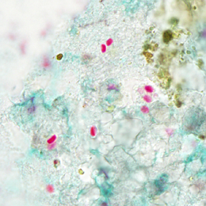 Tub_acrid_NIH_2012b.jpg