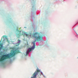 Tub_acrid_NIH_2012c.jpg