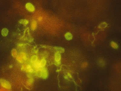 Ehellem_spores_IFA_2012.jpg