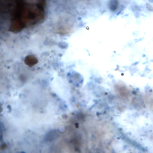 E_hominis_cyst_BAM2.jpg Figure A