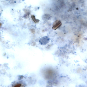 E_hominis_cyst_BAM3.jpg Figure B