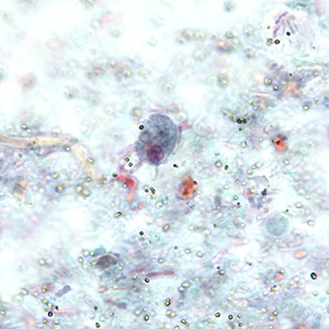 R_intestinalis_troph_BAM1.jpg Figure A
