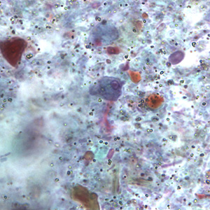 R_intestinalis_troph_BAM2.jpg Figure B
