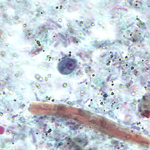R_intestinalis_cyst_BAM2.jpg Figure A