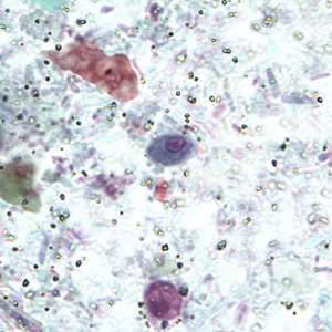 R_intestinalis_cyst_BAM4.jpg Figure C