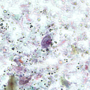 R_intestinalis_cyst_BAM5.jpg Figure D