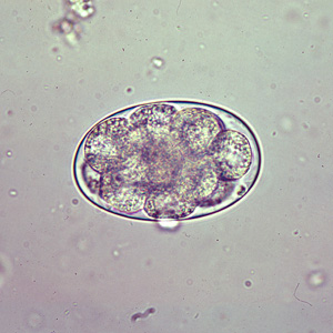 Oesophagostomum_egg_A.jpg