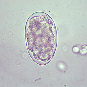 Oesophagostomum_egg_B.jpg