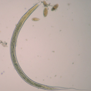 Oesophagostomum_L3_ZAF1.jpg