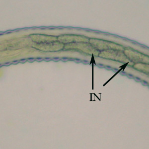 Oesophagostomum_L3_ZAF3.jpg