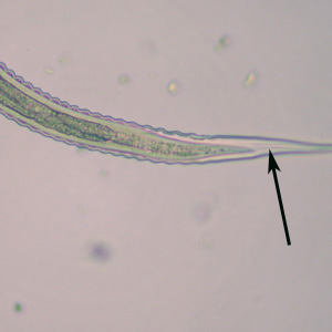 Oesophagostomum_L3_ZAF4.jpg