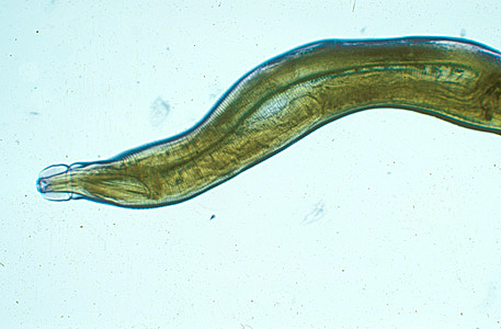 Oesophagostamum_BeaverA.jpg