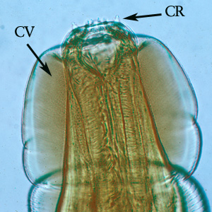 Oesophagostamum_BeaverC.jpg