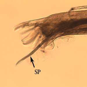 Oesophagostomum_BAM_bursa1.jpg