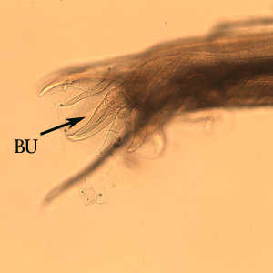 Oesophagostomum_BAM_bursa2.jpg