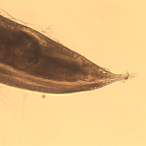 Oesophagostomum_BAM_female.jpg
