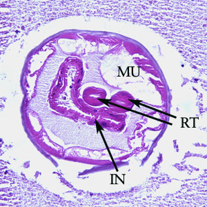 Oesophagostomum_BAM_200xA.jpg
