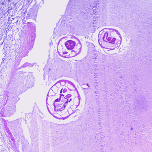 Oesophagostomum_BAM_40x.jpg