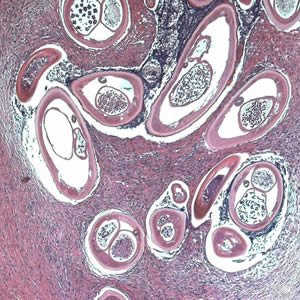 Ovolvulus_tissue2b.jpg
