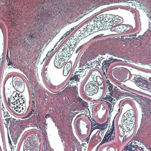 Ovolvulus_tissue3b.jpg