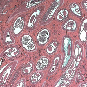 Ovolvulus_tissue4a.jpg