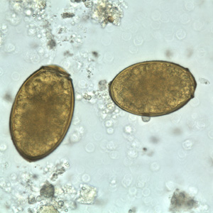 P_westermani_egg_wtmt_BAM2.jpg
