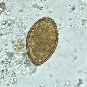 P_westermani_egg_wtmt_BAM3.jpg