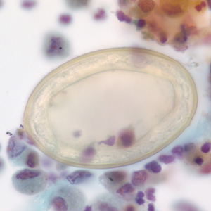 P_kellicottii_BAL1000x_Prokop.jpg
