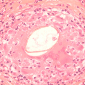 P_kellicottii_OK400x_ProkopA.jpg