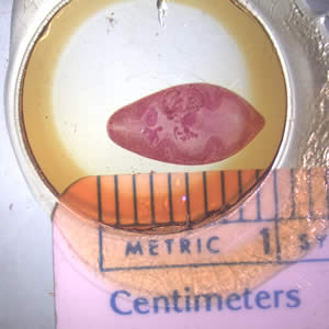 Paragonimus_adult_hematoxylin.jpg