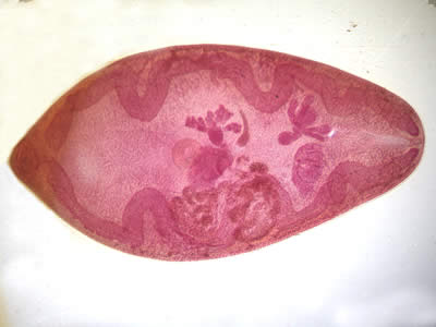 Paragonimus_adult_hematoxylin2.jpg