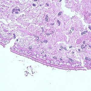 Paragonimus_cuticle_close-up.jpg