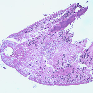 Paragonimus_oral_sucker.jpg