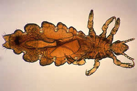 P_h_capitis_female1.jpg