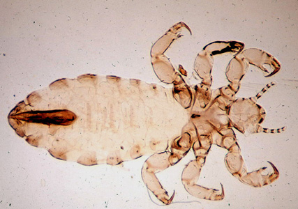 Pediculus_humanus_louse.jpg