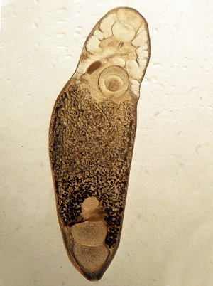 Adult_B Philophthalmiasis image