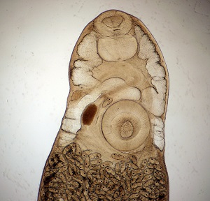 Adult_C Philophthalmiasis image