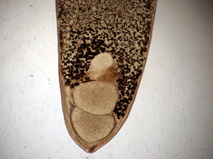 Adult_D Philophthalmiasis image