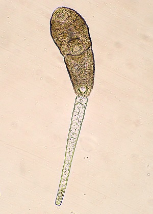 Cercaria_C Philophthalmiasis image