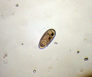Egg_A Philophthalmiasis image