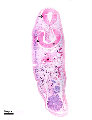 Histo_A Philophthalmiasis image