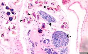 Histo_B Philophthalmiasis image